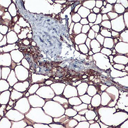 Perilipin 1 antibody